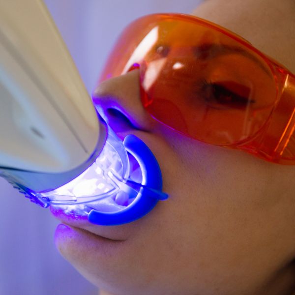 Teeth Whitening Training In-Person Course
