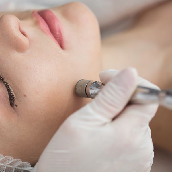 Microdermabrasion In-Person Class and Machine